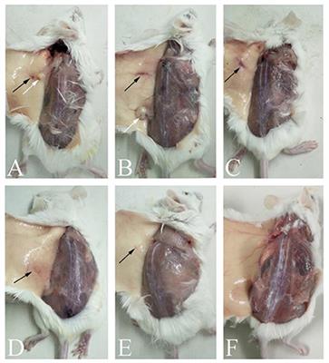 Screening immune adjuvants for an inactivated vaccine against Erysipelothrix rhusiopathiae